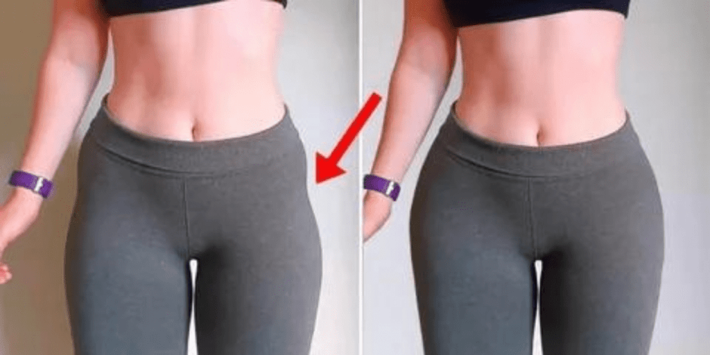 Hip Dips: What are Hip Dips, causes, Solutions, and More